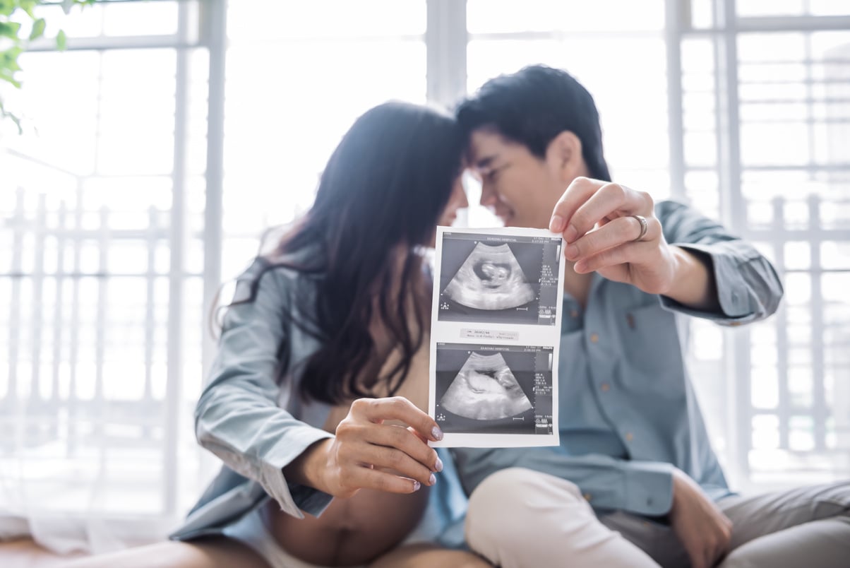 Pregnant Couple Holding an Ultrasound Scan of Their Baby